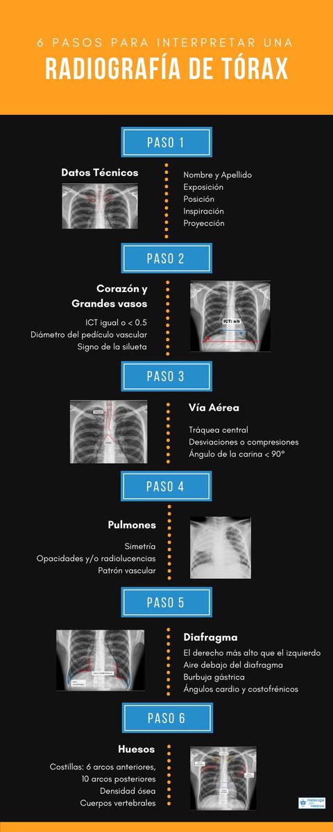 ENARM_intensivo's tweet photo. ✅INTERPRETACIÓN DE  LA  RADIOGRAFÍA  DE  TÓRAX

#ENARM_INTENSIVO https://t.co/F3O5Ju43to