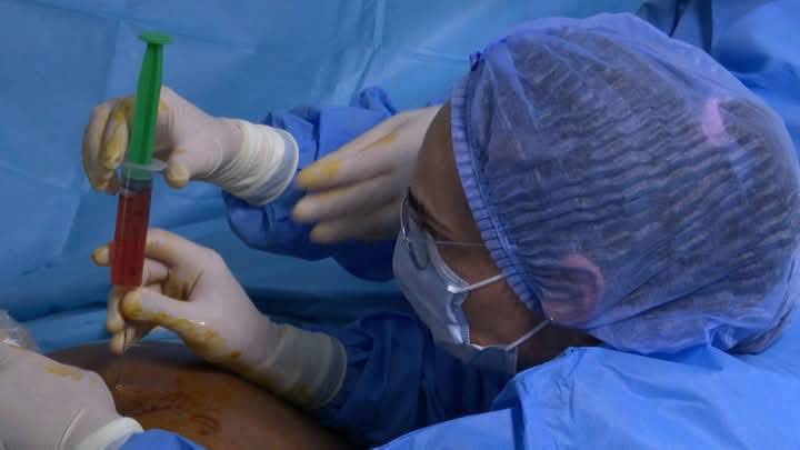 tunisialphanews's tweet photo. 🇹🇳🩺Un nouvel exploit médical a été réalisé par une équipe médicale tunisiennedu  Centre de Obstétrique et de Néonatologie de Tunis.

Un dispositif de drainage a été mis en place par l'équipe médicale pour recueillir les liquides des poumons d'un fœtus au début de son 7e mois, dans l'utérus de sa mère.

Dalenda Shell a été responsable de cette opération en collaboration avec la professeure 'Carmela Votino' et l'équipe médicale du service d'anesthésie et de réanimation sous la direction du professeur 'Hayen Maghrebi.

La réussite de l'opération illustre le développement et l'efficacité du secteur médical public tunisien, à la fois au niveau local et international.