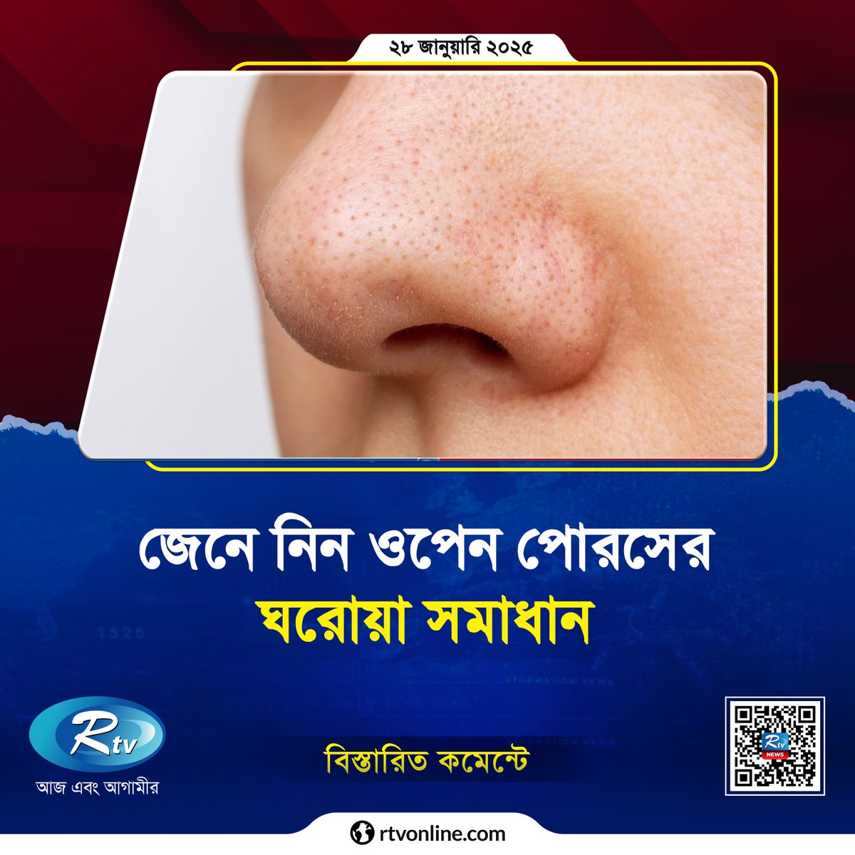 rtvonline's tweet photo. ওপেন পোরস নিয়ে চিন্তিত? ঘরোয়া উপায়েই হবে সহজ সমাধান!
#lifestyle #OpenPores #Rtvonline
https://t.co/Egv0MnxWif https://t.co/zWS9ASUYOr