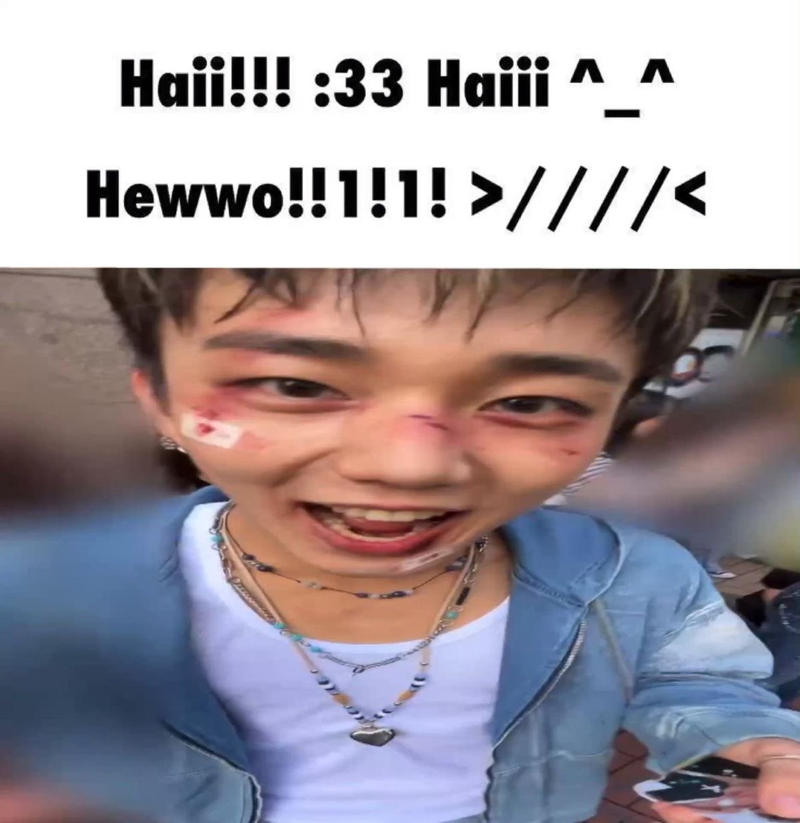 J1sungStar's tweet photo. LATE SELCA DAY ๐ฅ๐ฅ
#P1eceSelcaDay #P1SD #P1Harmony #ํผ์ํ๋ชจ๋ #INTAK #์ธํ #PSD #P1HarmonyWithP1ece
#PHSD https://t.co/zTXGfeSpJF