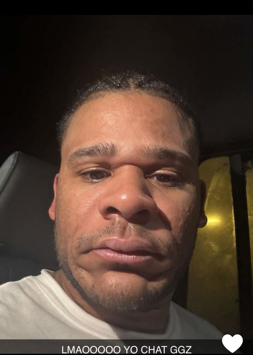 Fanum is currently at the hospital due to a bad allergic reaction