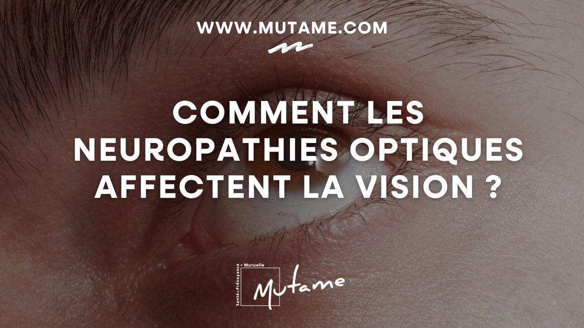 👉 👁️‍🗨️ Désignant les affections du nerf optique, les neuropathies optiques se manifestent par une baisse d’acuité visuelle et une altération de la vision des couleurs. Quels sont les symptômes et leurs traitements ?

 lnkd.in/e5SMB3iY

#santé  #prévention #ophtalmologie