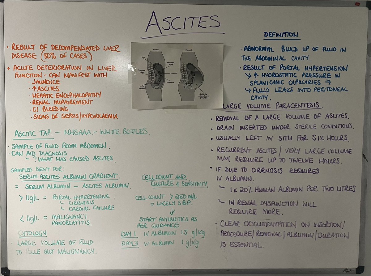 Marion Clark (@marionjclark19) on Twitter photo New year new teaching board. A very brief summary of ascites. What to look out for and some guidance on taps and LVP. <a href="/AAAcuteAdvPrac/">Advanced Practice NHS Ayrshire and Arran</a> #gastroteaching #hepatologyteaching New year new teaching board. A very brief summary of ascites. What to look out for and some guidance on taps and LVP. <a href="/AAAcuteAdvPrac/">Advanced Practice NHS Ayrshire and Arran</a> #gastroteaching #hepatologyteaching