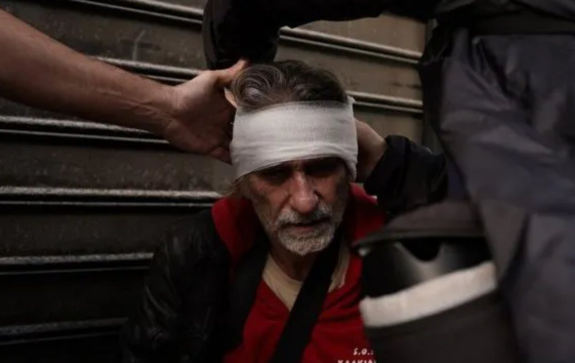 RSF (@rsf_inter) on Twitter photo #Greece: On 26/01, while covering a protest linked to theĀ #TempiĀ train accident in Athens, photojournalistĀ <a href="/lolosmarios/">lolos marios</a> was hit in the head by a flash grenade thrown by the police. RSF condemns this attack & urges the authorities to hold theĀ responsibleĀ officers accountable. #Greece: On 26/01, while covering a protest linked to theĀ #TempiĀ train accident in Athens, photojournalistĀ <a href="/lolosmarios/">lolos marios</a> was hit in the head by a flash grenade thrown by the police. RSF condemns this attack & urges the authorities to hold theĀ responsibleĀ officers accountable.