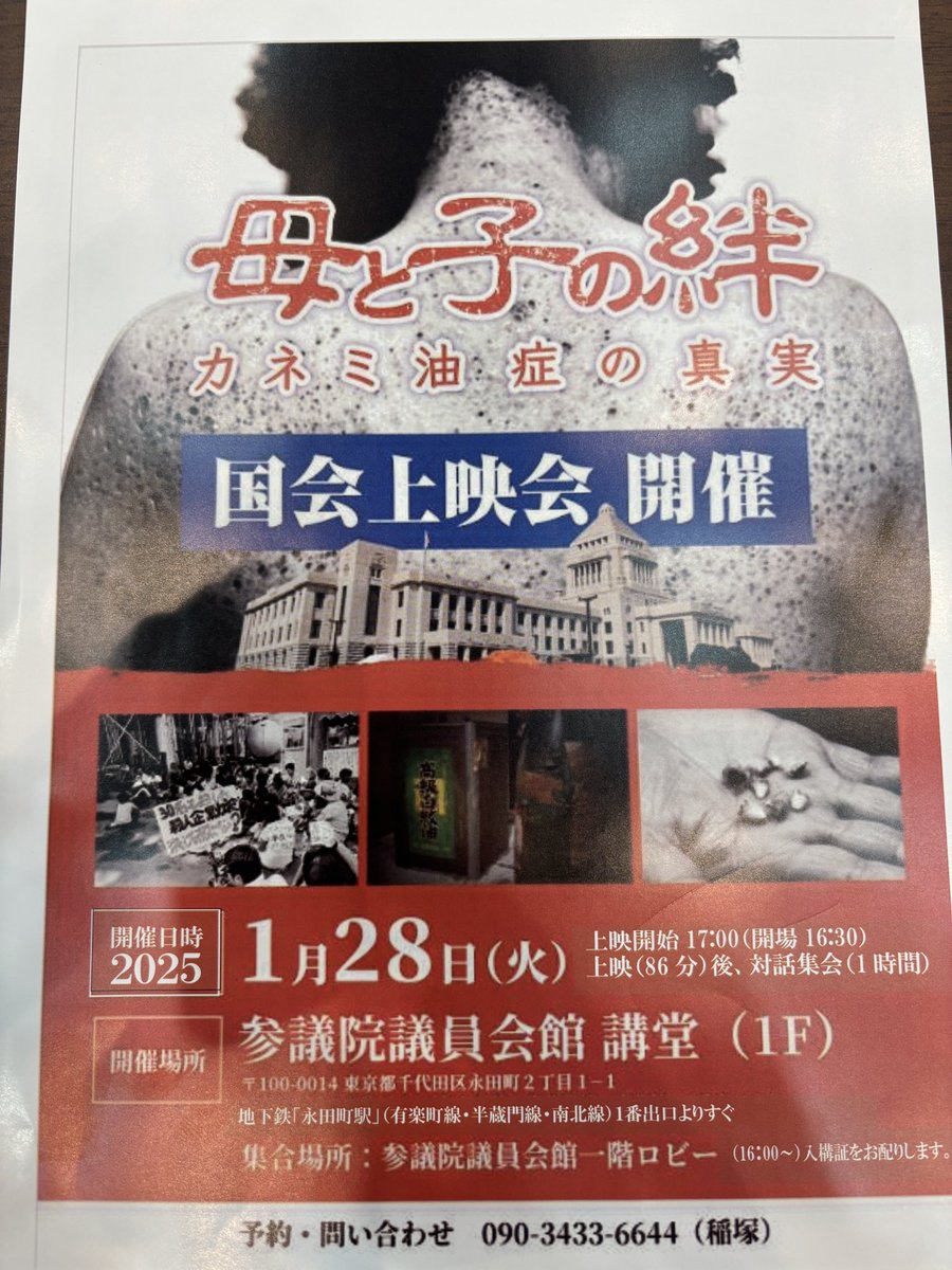 カネミ油症は未だ終わっていない 「母と子の絆」国会上映会&対話集会に
