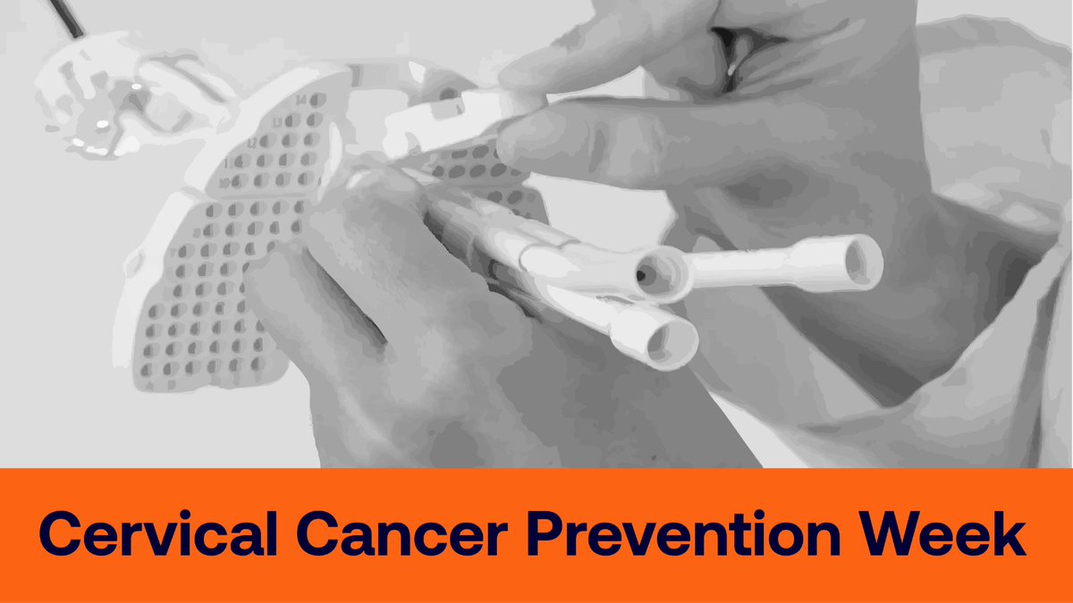 This #CervicalCancerPreventionWeek, we’re highlighting gynaecological cancers.

Charity funded brachytherapy at Guy's Cancer directly targets these tumours, improving patient outcomes.

You can support innovative treatments like this: guyscancercharity.org.uk/donate/

#GCCprojects
