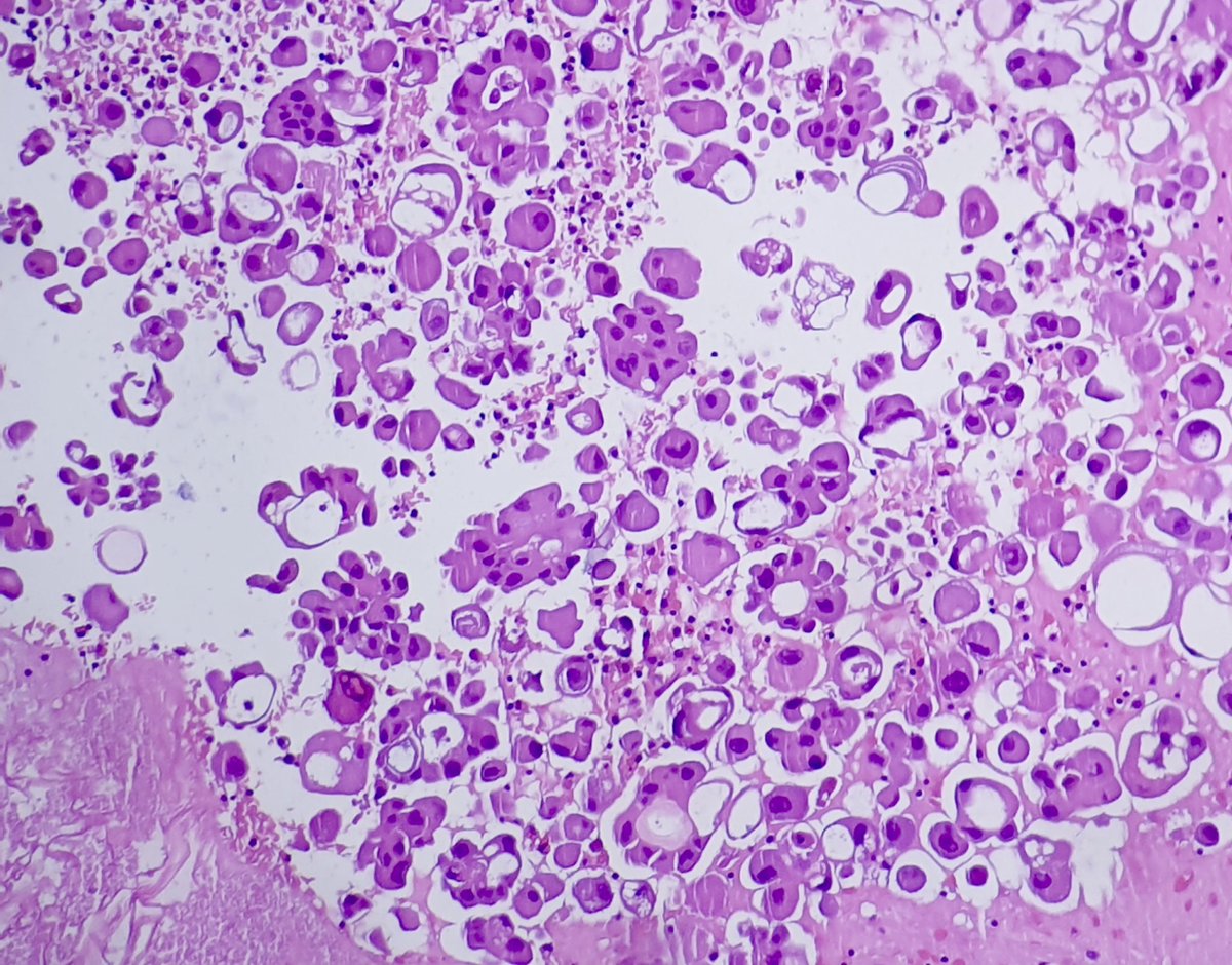 Fresia Wongkar tweet media