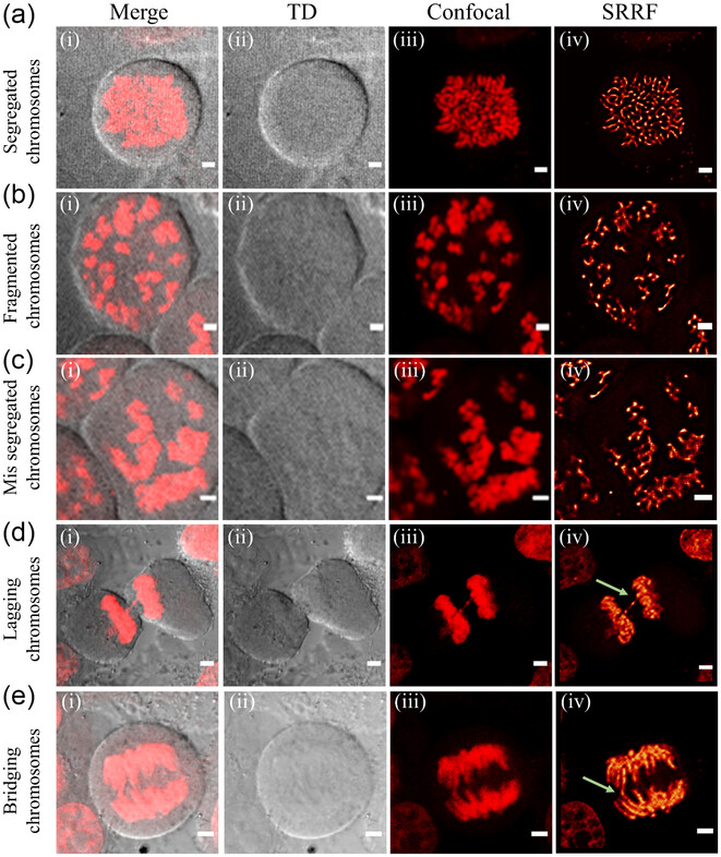 ckn_lab_IIT's tweet photo. Our latest article titled as "Carbon Nanodots as a Red Emissive  Fluorescent Probe for the Super-Resolution Microscopy of DNA Dynamics  during Paclitaxel Treatment" got published in Wiley's Small Structures. Congrats to Richa, Kush, &amp; Abdul for this work. https://t.co/HqUoUIdYjh https://t.co/cMyTyFBIIC