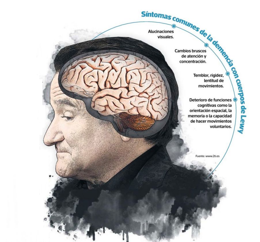 Más de 100.000 personas en España padecen demencia con cuerpos de Lewy news3edad.com/2025/01/27/mas…
#Neurología #Lewy #demencia