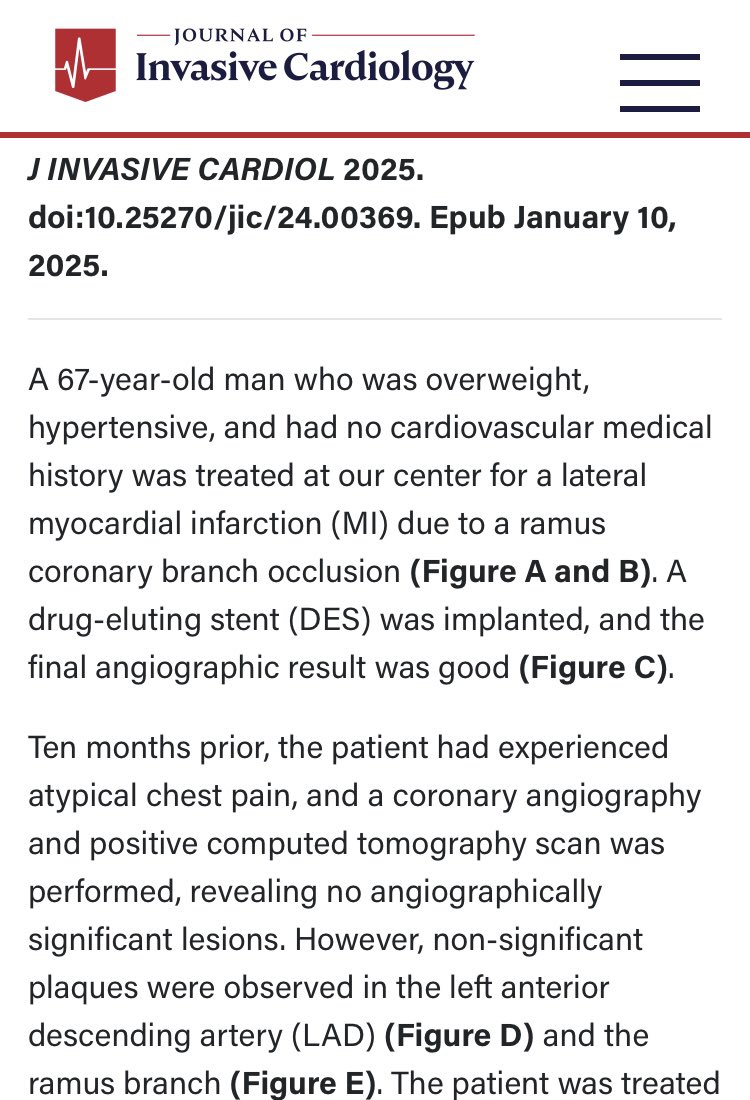 quentinlandolff's tweet photo. How to avoid a myocardial infarction with radial wall strain?
With the help of Dimitri Bussy and Patricia Mayer (MicroPort, MicroPort CRM) to perform RWS (Pulse Medical)
Charles Gallen, Mohamed amine boussofara, Quentin Landolff 
Journal of Invasive Cardiology https://t.co/NgbrA0DidF