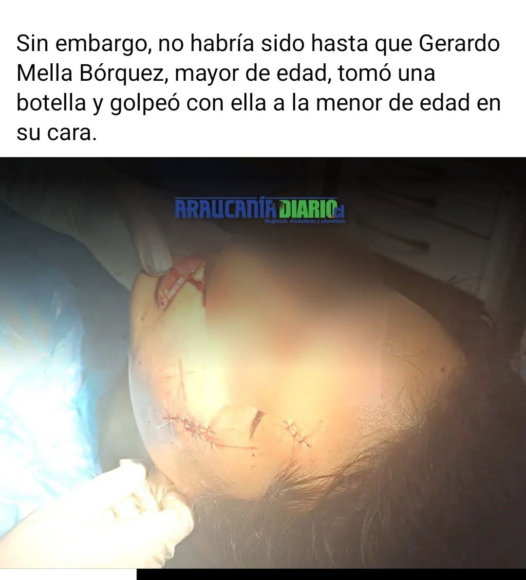 Neferkittycats's tweet photo. Clara Aguayo Fuentealba, junto a sus familiares, quienes con golpes de puño y pie se habrían abalanzado sobre la menor de edad. Gerardo Mella Bórquez, tomó una botella y golpeó con ella a la menor de edad en su cara. Ese es el hijo de puta q corto a la niña #contigoenlamañana https://t.co/ONRL267tOh