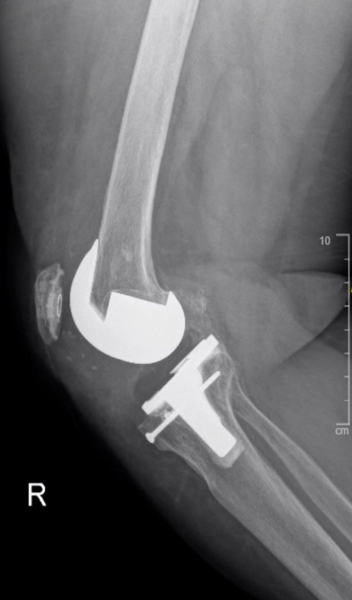 Mohammad Alzahrani - محمد مسفر الزهراني tweet media