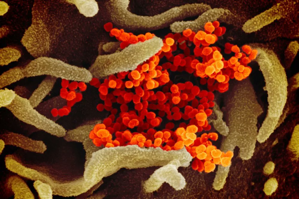 Memorial Sloan Kettering Cancer Center (@mskcancercenter) on Twitter photo MSK researchers are key contributors in a project called The Human Virome Program, which seeks to map the landscape of viruses in our bodies and to help analyze the impact they have on human health and disease. Learn more about MSK's <a href="/CalebLareau/">Caleb Lareau</a> and his team's exciting research: MSK researchers are key contributors in a project called The Human Virome Program, which seeks to map the landscape of viruses in our bodies and to help analyze the impact they have on human health and disease. Learn more about MSK's <a href="/CalebLareau/">Caleb Lareau</a> and his team's exciting research: