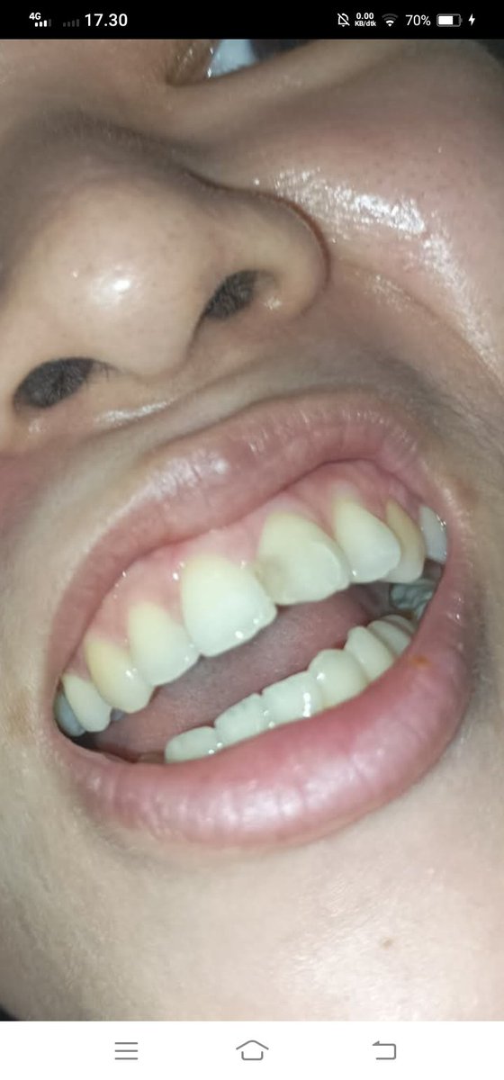 DentistRoom's tweet photo. #teeth #mouth #tongues #dentistry https://t.co/LJsvPRKeTV