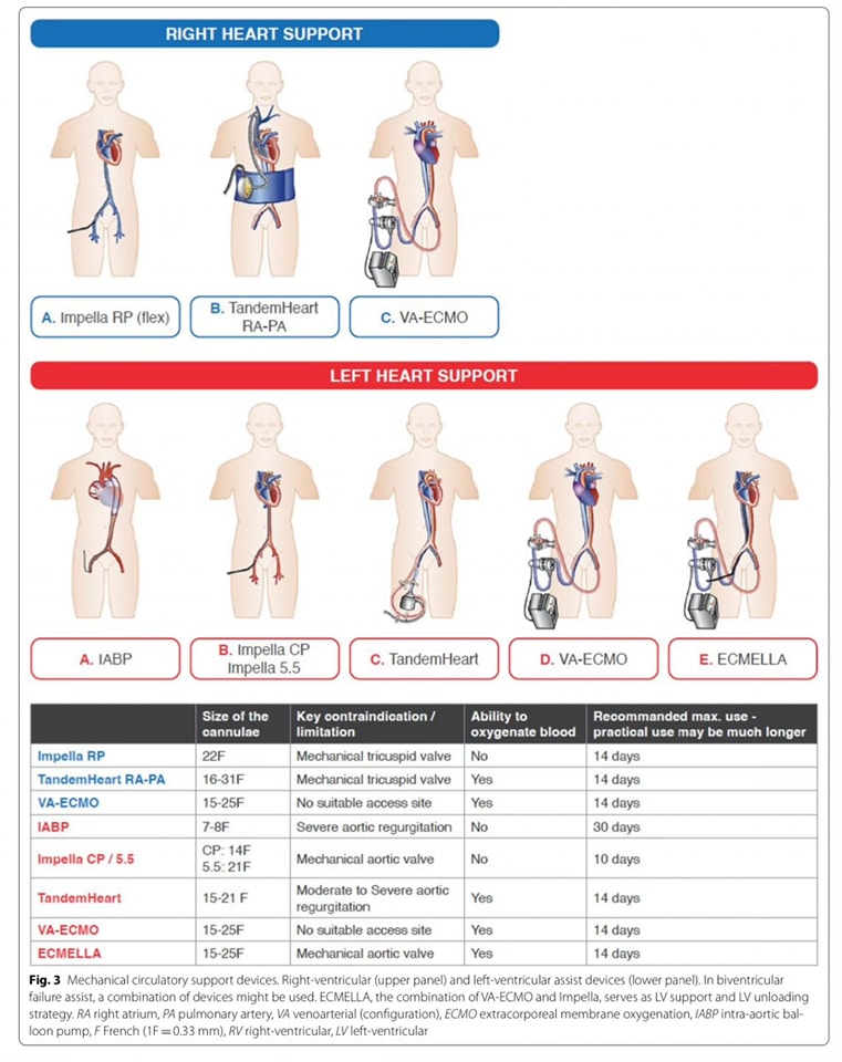 The Heart (@zheart11768530) on Twitter photo 🔴Management of cardiogenic shock, state-of-the-art⤵️  #2024Review #openaccess  
🔹 bit.ly/3XipcV3 🔴Management of cardiogenic shock, state-of-the-art⤵️  #2024Review #openaccess  
🔹 bit.ly/3XipcV3