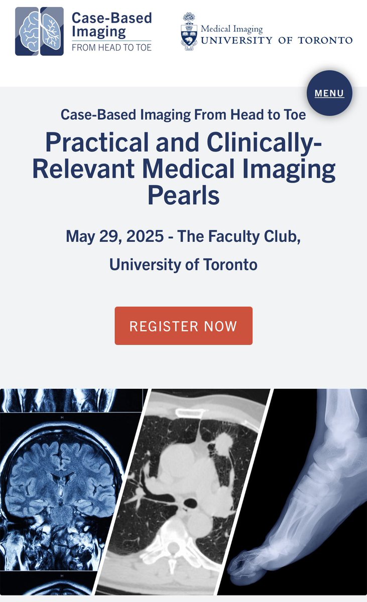 Kate Hanneman (@katehanneman) on Twitter photo Don't miss the inaugural <a href="/UofTMedIm/">UofT Medical Imaging</a> Case-Based Imaging Symposium on May 29, 2025! Stellar faculty include <a href="/sanjeevbhalla/">sanjeevbhalla</a> <a href="/LJProbyn/">Linda Probyn</a> <a href="/obenfine/">Ben Fine</a> <a href="/SupriyaKulk/">Supriya Kulkarni</a> <a href="/KartikJhaveri1/">Kartik Jhaveri</a> and more! Registration is now open with early bird pricing until April 25 🐦⏳⬇️
cpd.utoronto.ca/caseimaging/?u… Don't miss the inaugural <a href="/UofTMedIm/">UofT Medical Imaging</a> Case-Based Imaging Symposium on May 29, 2025! Stellar faculty include <a href="/sanjeevbhalla/">sanjeevbhalla</a> <a href="/LJProbyn/">Linda Probyn</a> <a href="/obenfine/">Ben Fine</a> <a href="/SupriyaKulk/">Supriya Kulkarni</a> <a href="/KartikJhaveri1/">Kartik Jhaveri</a> and more! Registration is now open with early bird pricing until April 25 🐦⏳⬇️
cpd.utoronto.ca/caseimaging/?u…
