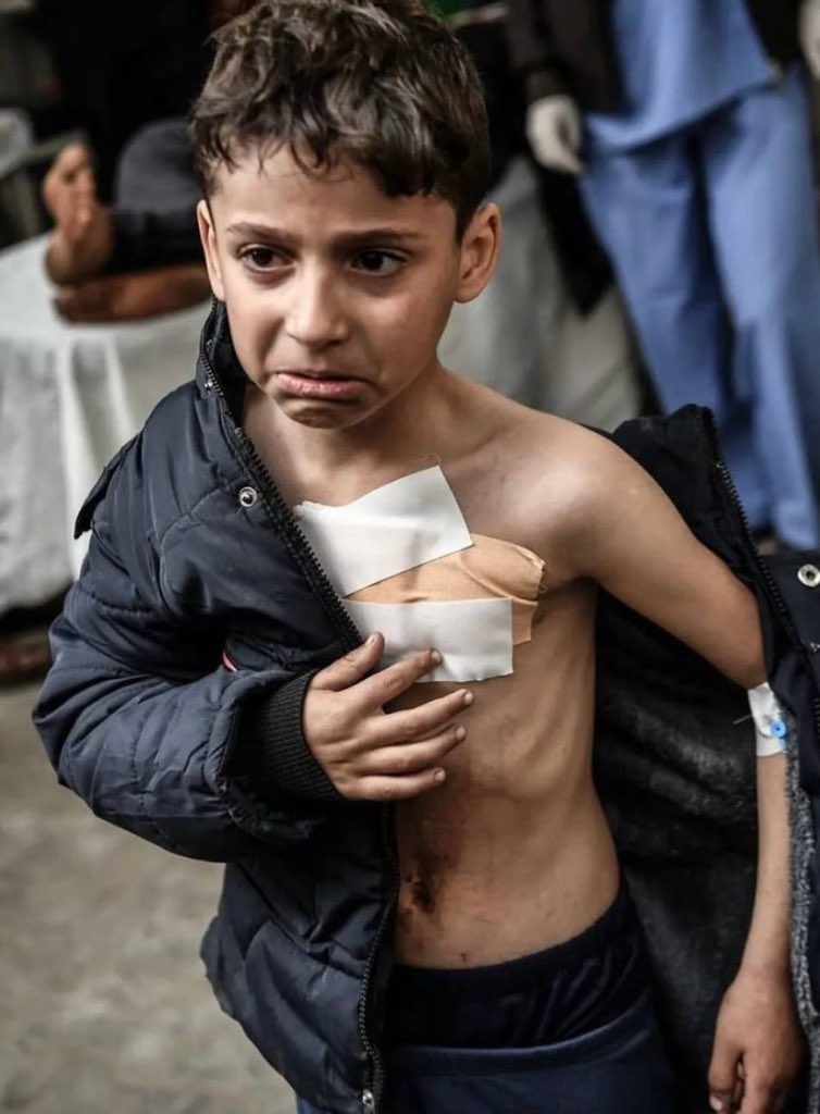 We are like a multitude of impossibilities..
Here we will stay, a weight on your heart,
Like a wall.
In your throats,
We are like a piece of glass, like a prickly pear.
And in your eyes,
We are a fire storm.
We are here to stay, like a wall over your chests. #Gaza