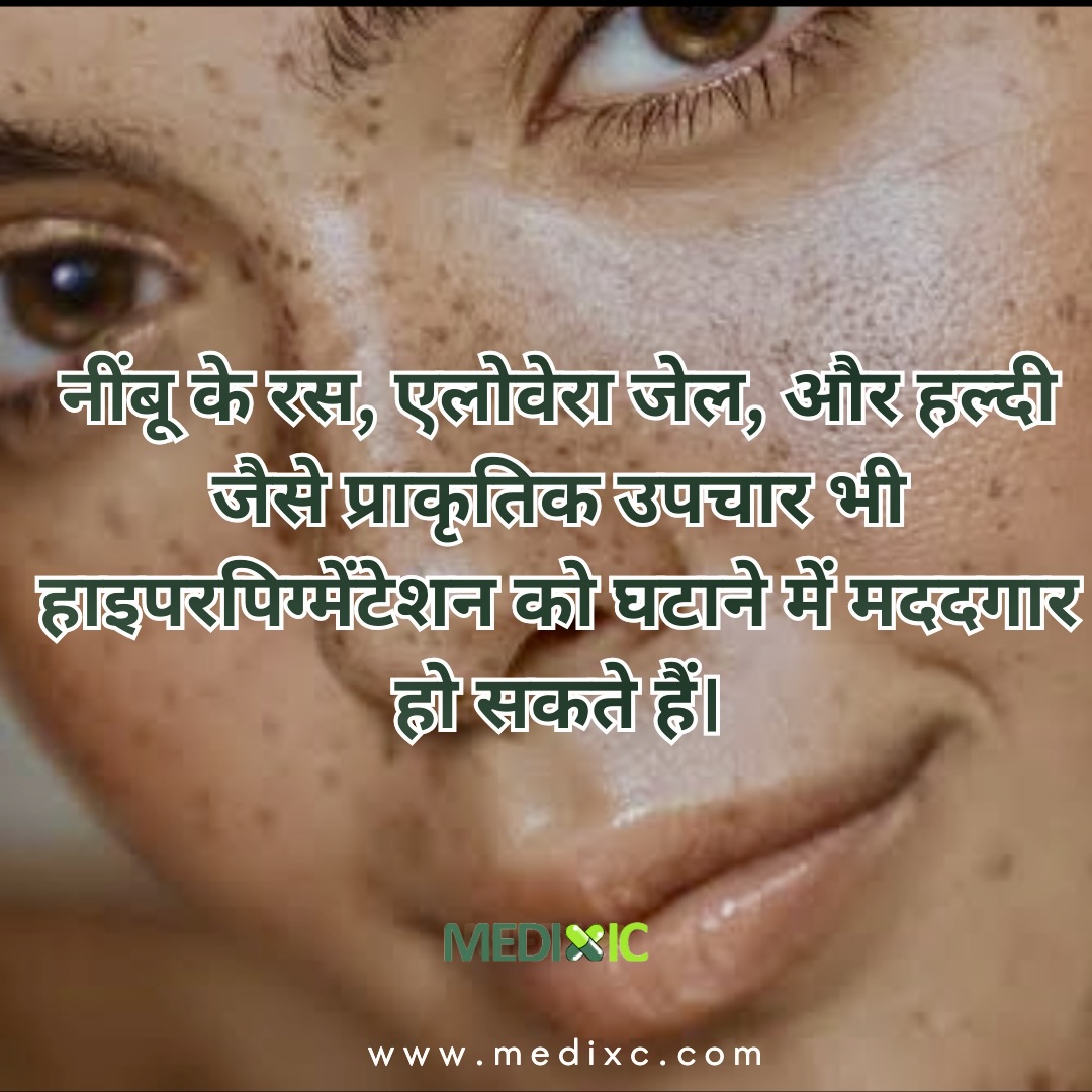 medixic's tweet photo. हाइपरपिग्मेंटेशन को ठीक कैसे करें 3 प्रभावी टिप्स 

Follow @medixic For more Healthy Tips 

#hyperpigmentation #pigmented #tipstofollow #explore #Pigmentation #skincare #skincareroutine https://t.co/hc05cr4UJI