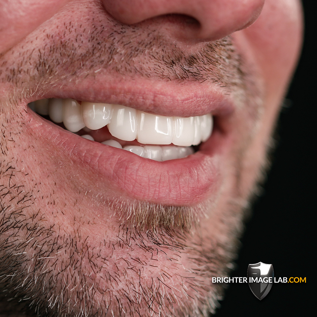 brighterimage01's tweet image. Capturing our work in ultra close-up detail, because incredible work deserves incredible photos 📸. Learn more about what we do on our profile.

#CaughtIn4k #UltraHDPhotography #IncredibleWork #BrighterImageLab #BIL #IncrediBIL #Veneers #RemovableVeneers #BILVeneers #SmileGoals