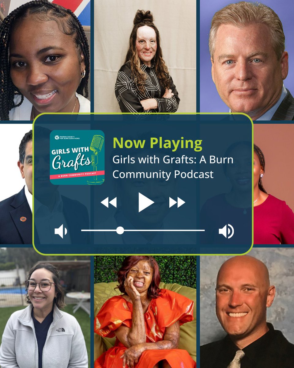 Season Five of Girls with Grafts was one for the books! 🎙 This season, we explored resilience, recovery, and the power of community with incredible guests and meaningful conversations. #GirlswithGrafts #burnsurvivor #podcast