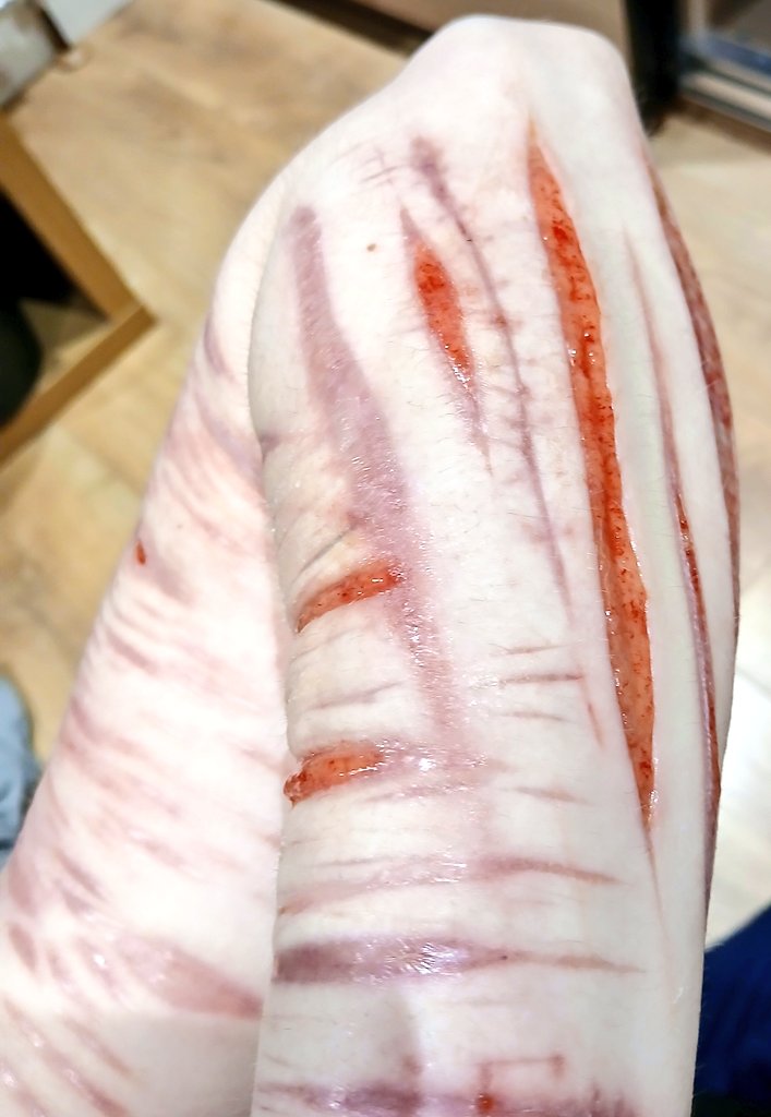 3PorridgeBears's tweet photo. Surprise surprise, I cut myself again (far right) cut from a few days ago https://t.co/6LRlcQJejU