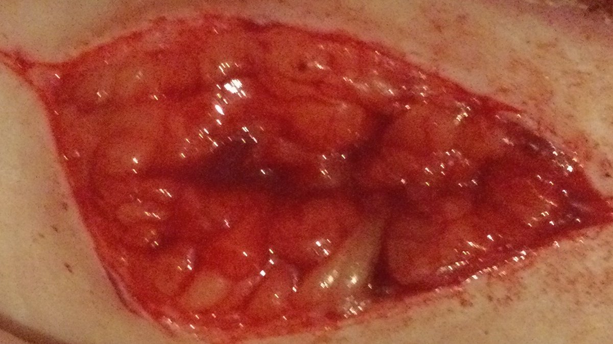 tism_eater's tweet photo. Fuck it we ball
Deep beans + long cut
#shtwt https://t.co/sKkQLBCTch