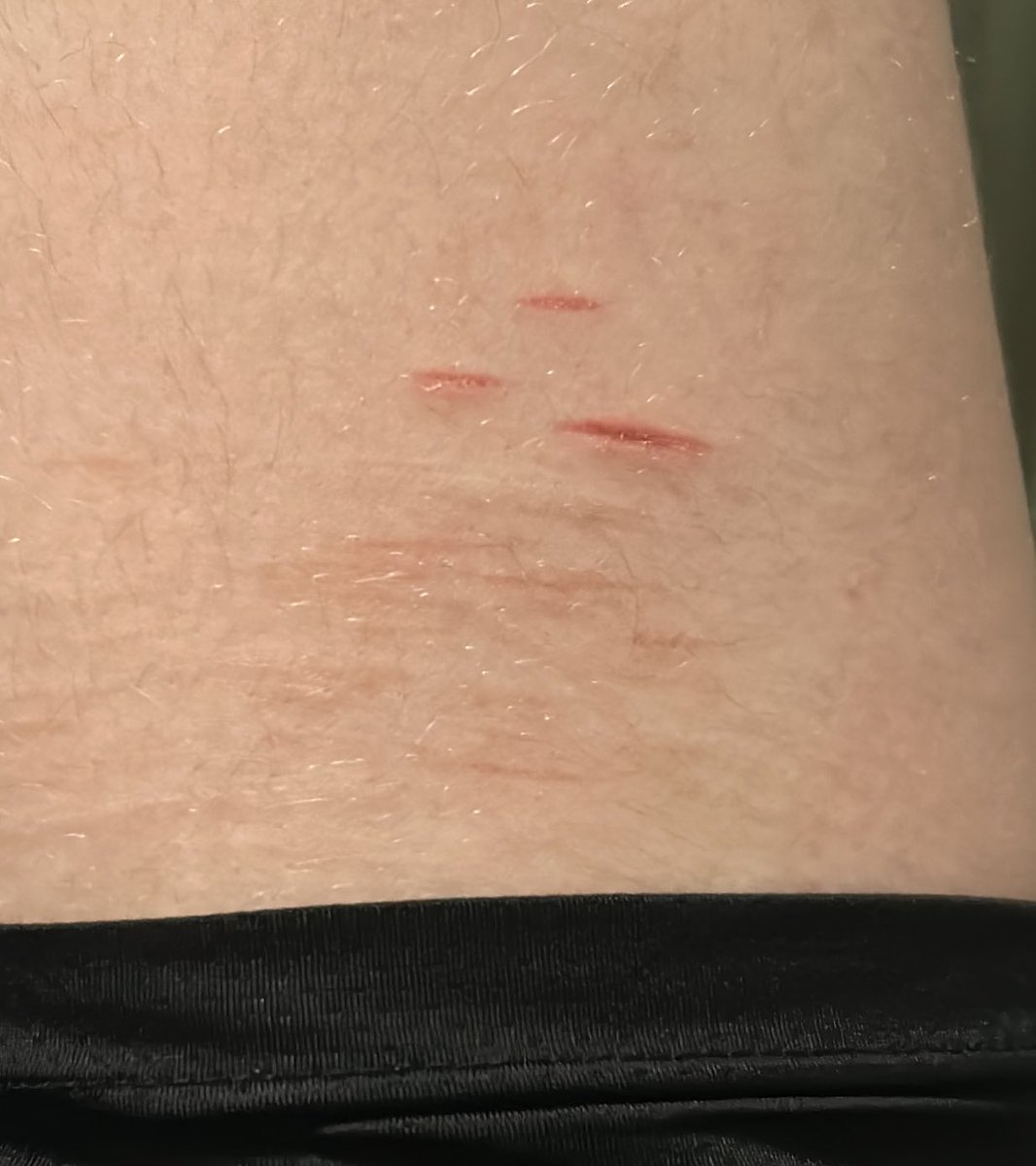 Some styros at various healing stages