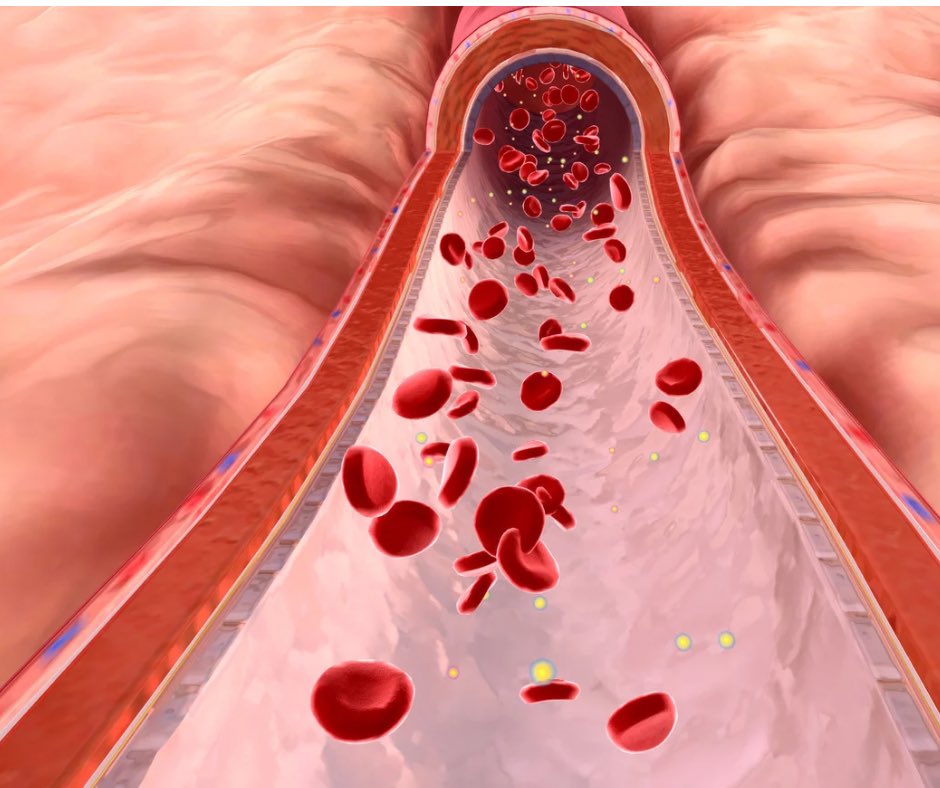 Keto_Sandra's tweet photo. Starke Arterien, gesundes Herz: So unterstützt Du Deinen Körper!

Dieses Bild zeigt eine Arterie mit roten Blutkörperchen in einem sauberen Blutkanal. Genau das kannst Du mit der richtigen Ernährung fördern: bessere Blutfettwerte und weniger Entzündungen. Studien zeigen, dass eine kohlenhydratarme Ernährung den HDL-Spiegel (das „gute“ Cholesterin) erhöhen und ungesunde Blutfette senken kann. Der Verzicht auf Zucker und verarbeitete Kohlenhydrate stabilisiert den Blutzucker und schützt die Gefäße. Gesunde Fette aus Avocados, Olivenöl und Fisch halten Deine Arterien flexibel. Gleichzeitig hilft der Fettstoffwechsel, überschüssiges Bauchfett zu reduzieren – ein wichtiger Faktor für ein gesundes Herz. Das Ergebnis? Stabile Werte und ein starkes Herz-Kreislauf-System!

#gesundesherz #blutfettwerte #lowcarb #gefäßgesundheit #herzschutz #blutzucker