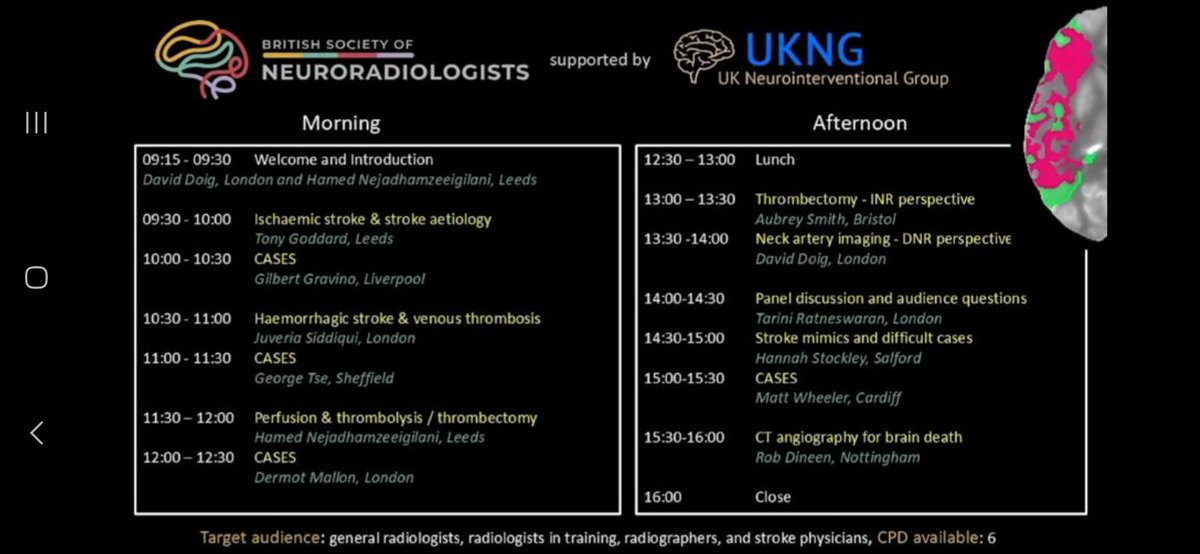 🚨 Less than 3 days to go! 🚨

Don’t miss out on the inaugural BSNR Online Stroke Imaging Study Day, supported by <a href="/UKNGNeuro/">UKNG</a>. 

📅 Date: 31/01/2025
⏰ Time: 0915 - 1600
📍 Location: Online
👉 Hurry! Registration is still open! Secure your your spot now: bit.ly/StrokeDayRegis…