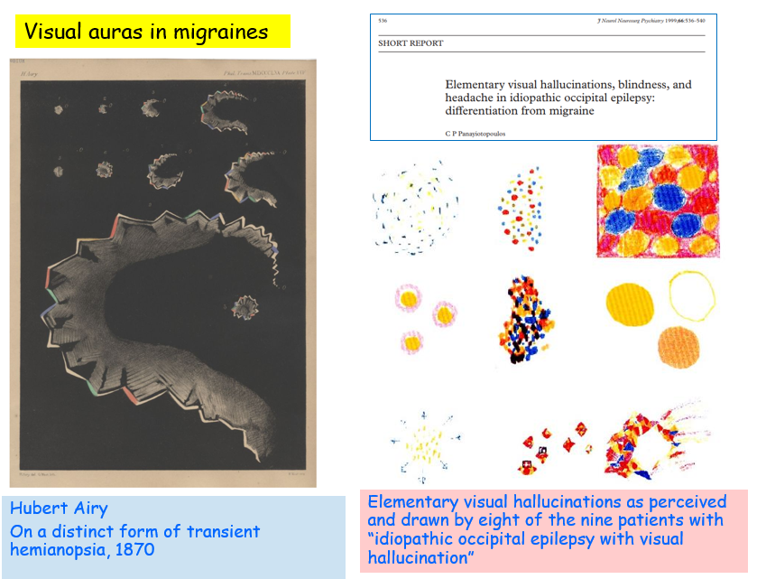 Visual auras in migraines and occipital lobe epilepsy can seem similar but have distinct differences. See the depiction of patients experiencing occipital sz and the classic draw of Hubert Airy. Auras develop slowly in migraines, suddenly in epilepsy featuring spots and colors