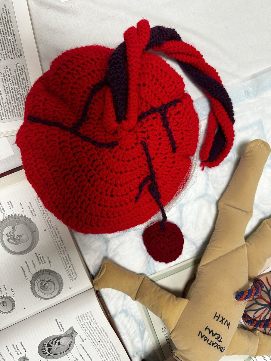 #Placenta Awareness Week! 
With our new #SuccenturiateLobe #Midwives I am sure you will appreciate this! Thank you <a href="/midwifemarge/">Lynn Maycroft</a> for knitting our placenta!