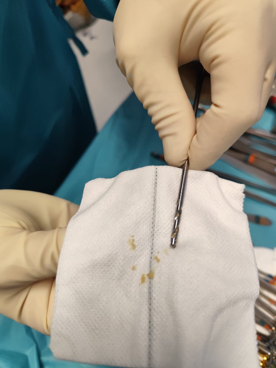 En este estado ha llegado a quirófano el material supuestamente estéril (eso son restos de hueso de la operación anterior). 

El riesgo de infección es enorme. 

Este es el precio de externalizar el servicio de esterilización del Hospital 12 de Octubre.