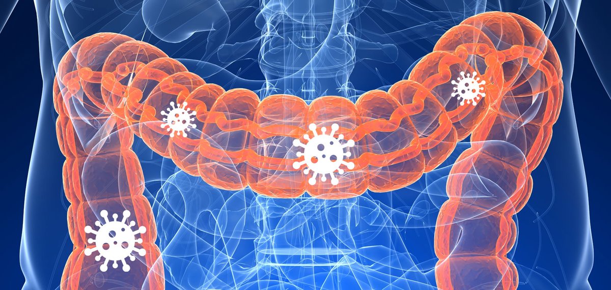 bprc_eu's tweet image. SARS-CoV-2 blijft &amp;gt;21 dagen actief in darmen van resusaap, met besmettelijk virus in ontlasting. 
Belangrijk inzicht voor monitoring en verder onderzoek naar darmontsteking en virusverspreiding. 🦠💩 

bprc.nl/nl/blog/virus-…

#COVID19 #Onderzoek #BPRC