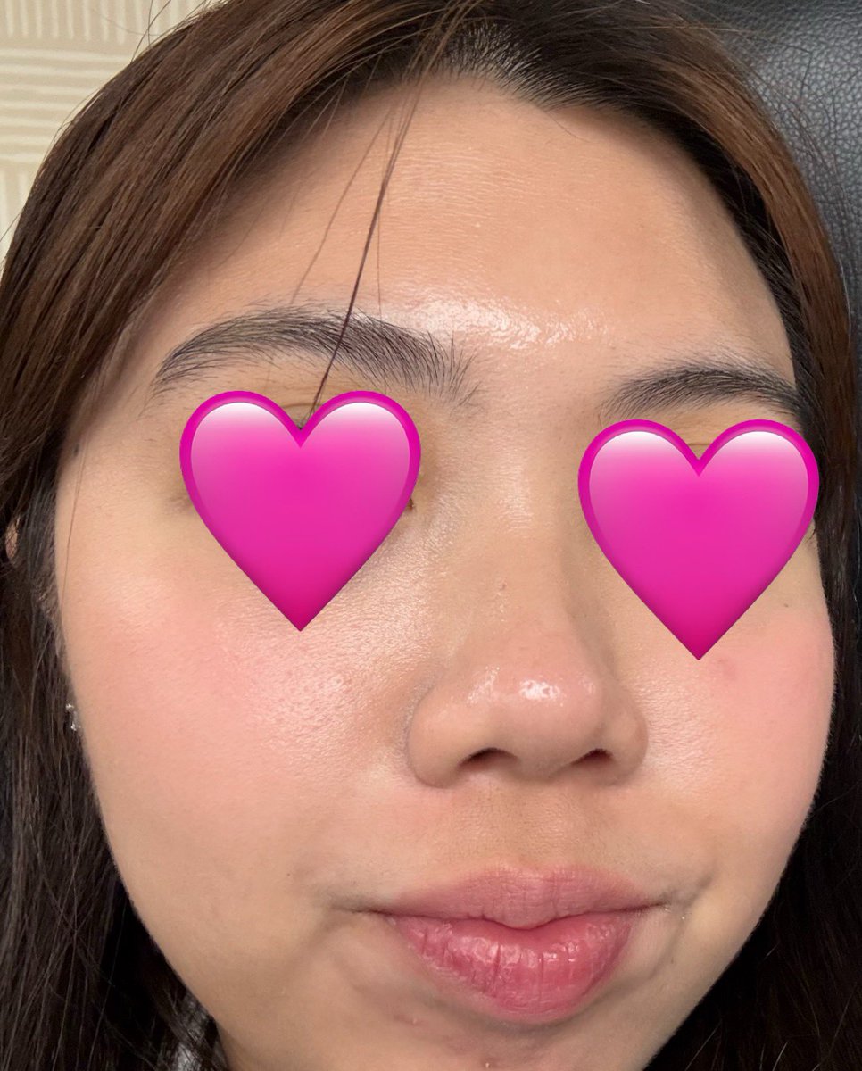 k-skin care is so real thank u so much for your service needly toner pads 😭 

  2023                                2025