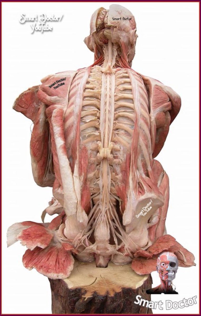 AbretuPotencial's tweet image. 14. ¡Increíble vista del sistema nervioso humano! 

Se muestran el cerebro, la médula espinal, la cola de caballo, los nervios raquídeos y el plexo lumbar.