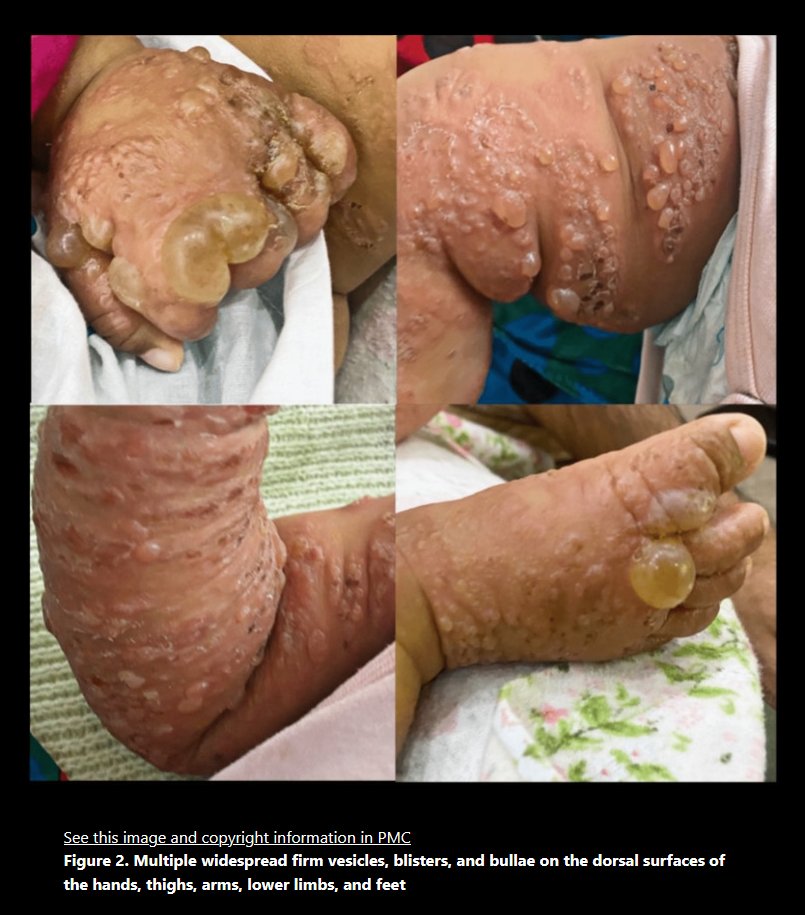 a_concerned_amyloidosis💜🐭🇩🇪 tweet media