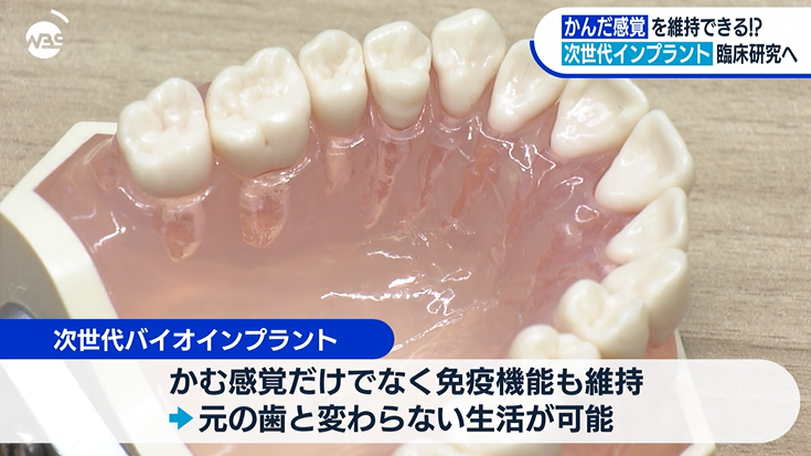 marketmaker7's tweet photo. これは画期的！
「次世代バイオインプラント」

歯根膜が機能するので噛む感覚があり、免疫機能も維持！まるで自分の歯のようになる！

ゲームチェンジャーになるインプラント！ https://t.co/TCGv6U58Yn
