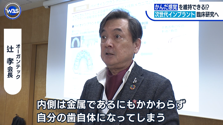 marketmaker7's tweet photo. これは画期的！
「次世代バイオインプラント」

歯根膜が機能するので噛む感覚があり、免疫機能も維持！まるで自分の歯のようになる！

ゲームチェンジャーになるインプラント！ https://t.co/TCGv6U58Yn