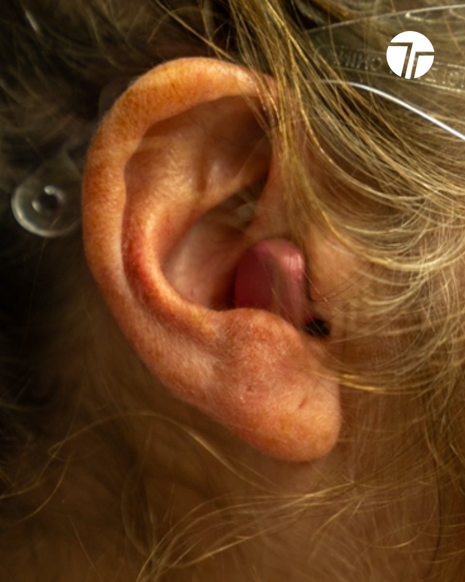 TechTeysha's tweet image. Psst...Listen to this!👂

We&apos;ve made earplugs from our innovative material, AggiePol.

Unlike traditional #plastic earbuds, they can biodegrade naturally when thrown away!