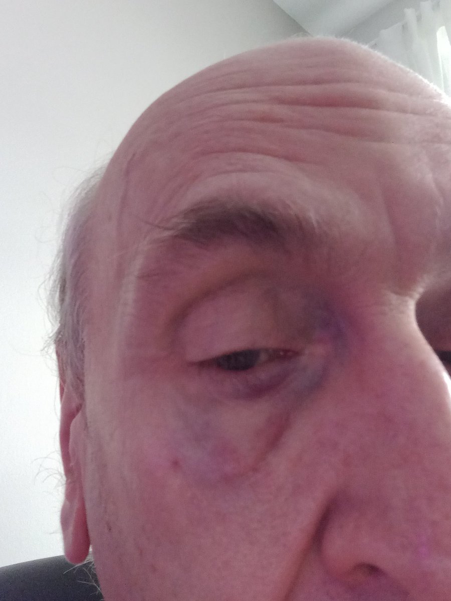 Dan Hickling (@danhickling) on Twitter photo Hockey ๐ photography ... it can be rough ... <a href="/mhick1953/">Margaret Hickling</a> <a href="/_Neutral_Zone/">Neutral Zone</a> @UpperDeckHockey <a href="/eliteprospects/">Elite Prospects</a> Hockey ๐ photography ... it can be rough ... <a href="/mhick1953/">Margaret Hickling</a> <a href="/_Neutral_Zone/">Neutral Zone</a> @UpperDeckHockey <a href="/eliteprospects/">Elite Prospects</a>