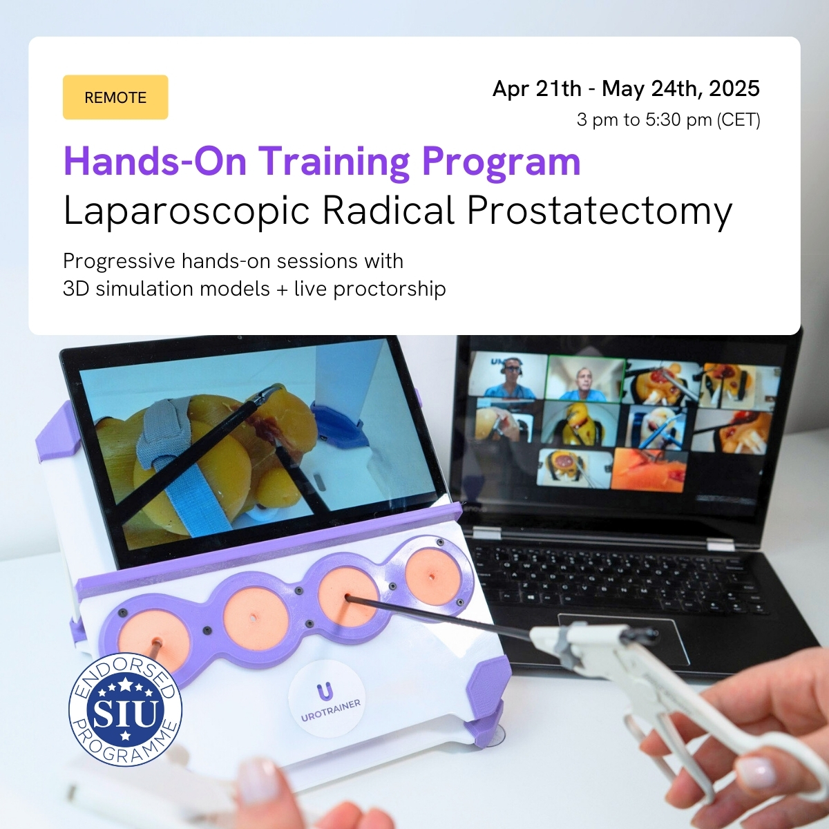 Join the 𝗛𝗮𝗻𝗱𝘀-𝗢𝗻 𝗣𝗿𝗼𝗴𝗿𝗮𝗺: 𝗟𝗮𝗽 𝗣𝗮𝗿𝘁𝗶𝗮𝗹 𝗡𝗲𝗽𝗵𝗿𝗲𝗰𝘁𝗼𝗺𝘆, endorsed by <a href="/SIU_urology/">SIU-Urology</a>, and train with hyper-realistic models under expert guidance.
📅 April 21 - May 24, 2025
⏳ Last day to enroll: April 11
🔗 Sign up now qj0kj3z7mrh.typeform.com/to/KVqseZ4D?ty…