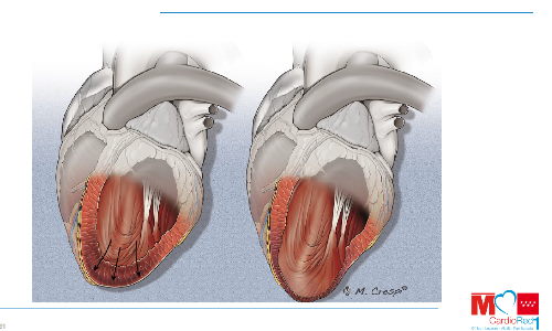 CardioTeca (@cardioteca) on Twitter photo ☑️ Aneurisma ventricular postinfarto - Sesión bibliográfica
Gonzalo García Martí <a href="/GGarciaMarti/">Gonzalo García-Martí, MD</a>
✏️ Regístrate en CardioTeca y descarga las diapositivas ⤵️
cardioteca.com/diapositivas-p… ☑️ Aneurisma ventricular postinfarto - Sesión bibliográfica
Gonzalo García Martí <a href="/GGarciaMarti/">Gonzalo García-Martí, MD</a>
✏️ Regístrate en CardioTeca y descarga las diapositivas ⤵️
cardioteca.com/diapositivas-p…