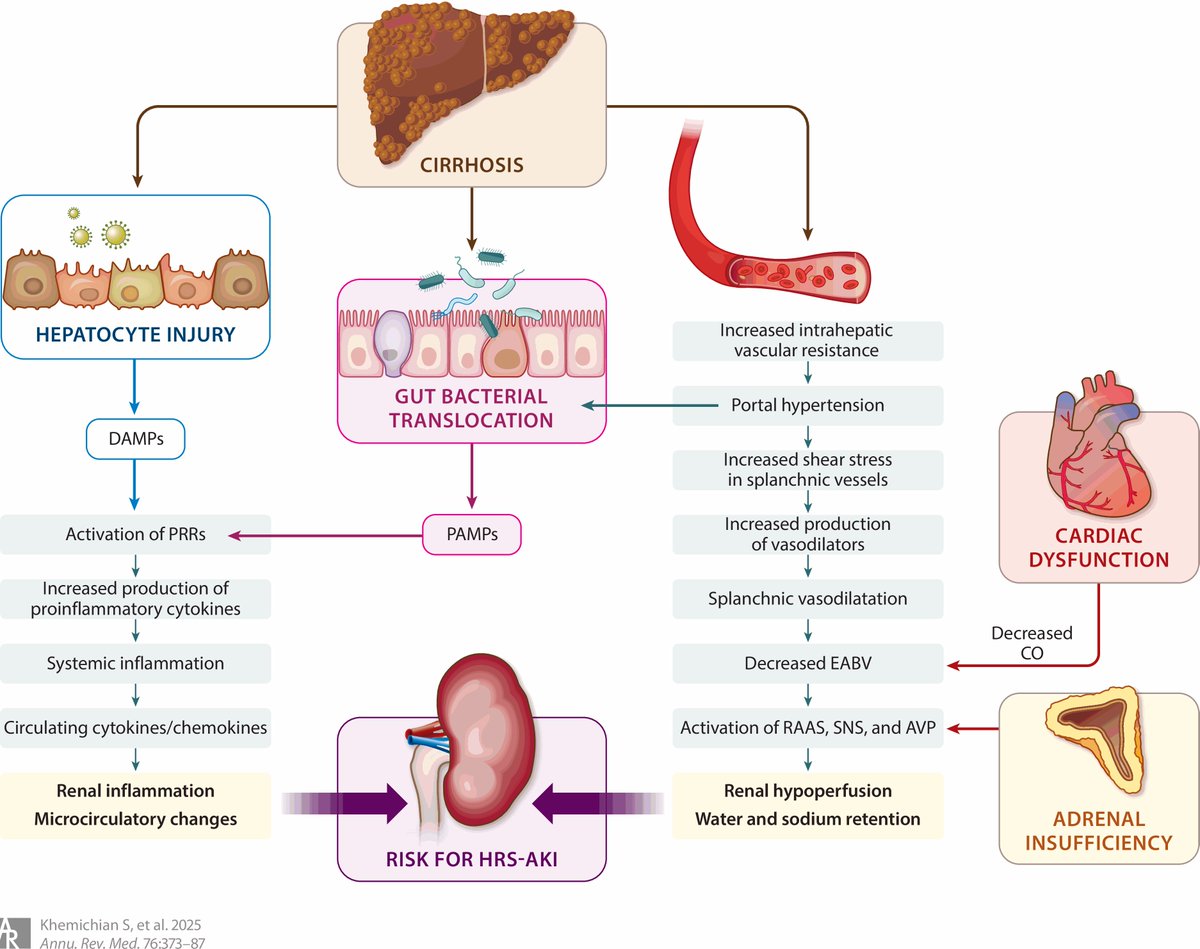 Update on Hepatorenal Syndrome: From Pathophysiology to Treatment

CCR Journal Watch
criticalcarereviews.com/latest-evidenc…

Get the latest critical care literature every weekend via the CCR Newsletter - subscribe at criticalcarereviews.com/newsletters/su…
