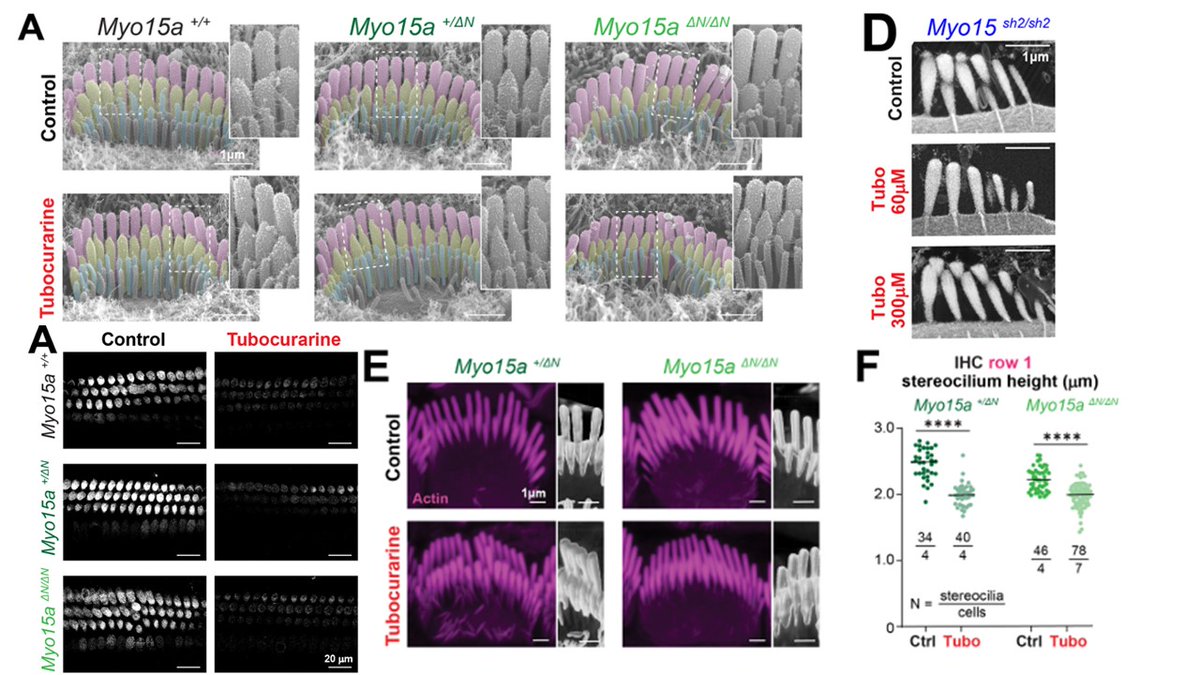 HearingShef's tweet image. Today's paper spotlight comes from Ana I. López-Porras and was published in December last year. This beautiful paper adds some understanding to the role Myo15 and the hair cell transducer current plays in remodelling stereocilia! Definitely worth a read!🔎pmc.ncbi.nlm.nih.gov/articles/PMC11…