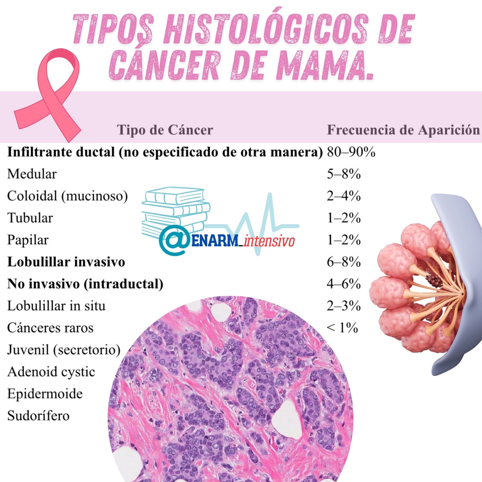 Tipos histológicos de cáncer de mama