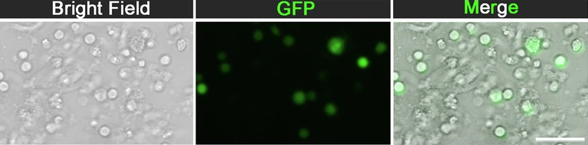 Endothelial Cell News (@endothelialnews) on Twitter photo Scientists from <a href="/CAS__Science/">Chinese Academy of Sciences</a> generated functional HSPCs in vitro from #endothelial cells (ECs) at various sites, including the aorta-gonad-mesonephros region and the placenta, by engineering vascular niche ECs.
🖨️ <a href="/CellDiscovery/">Cell Discovery</a>
go.nature.com/3WEEGTI Scientists from <a href="/CAS__Science/">Chinese Academy of Sciences</a> generated functional HSPCs in vitro from #endothelial cells (ECs) at various sites, including the aorta-gonad-mesonephros region and the placenta, by engineering vascular niche ECs.
🖨️ <a href="/CellDiscovery/">Cell Discovery</a>
go.nature.com/3WEEGTI