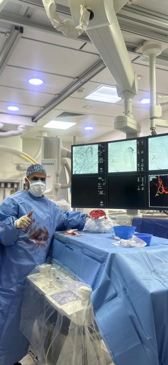 DrAlenazy's tweet image. حمدلله للتو  تم عمل اول حالة في مدينة الملك سعود الطبية 
لمريض في السبعينيات من عمره يشكي من الم حاد في البطن ،بعد عمل الاشعة المقطعيه تبين وجود جلطه حاده في شريان الامعاء الدقيقه ،
كلموني عليها اطباء الجراحه لامكانية ازالة الجلطه والحفاظ على الامعاء 
 تم الدخول عن طريق شريان…