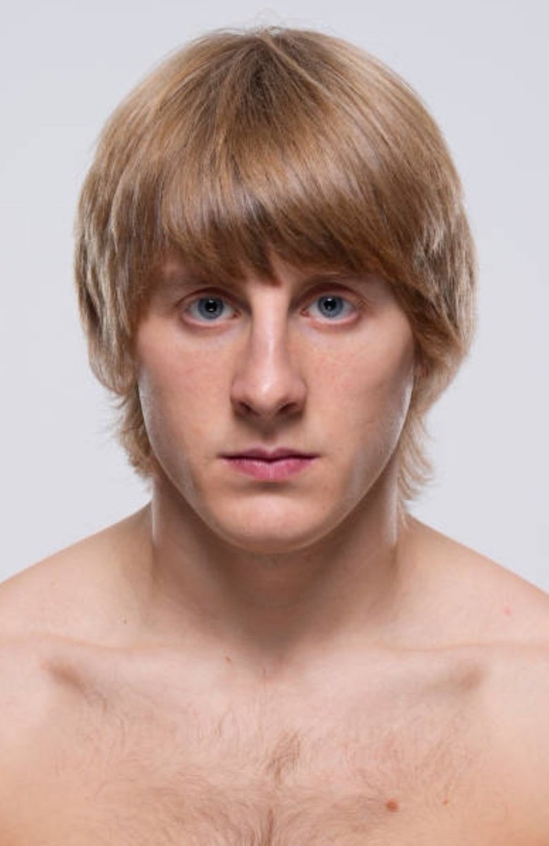 37Lemons's tweet photo. Female mixed martial artist
Paddy Pimblett

They are ALL inverted in the UFC

1) oval skull, shallow-set eyes too close together, narrow cheeks, tiny mouth, pink lips, sloping jaw, no Adam's Apple
2) female hips, gait, &amp; Q-angle
3) T-Rex arms, female curves/bum
4) girl hair, hand https://t.co/g6nci9GRAb