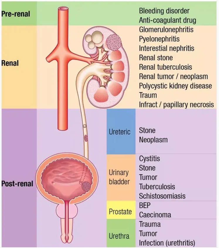 MedInsightMD's tweet photo. 𝗕𝗹𝗼𝗼𝗱 𝗶𝗻 𝘂𝗿𝗶𝗻𝗲 𝗰𝗮𝘂𝘀𝗲𝘀 📚 https://t.co/aKlEt3v0Sz
