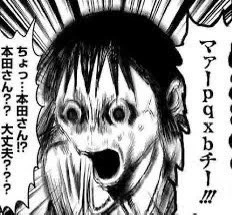数年前に歯医者さんで研修医の人から喉とベロの間吸われてこうなったことある 